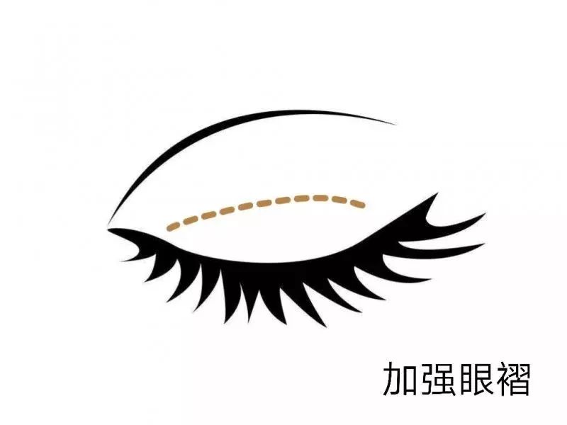 加強(qiáng)眼褶 